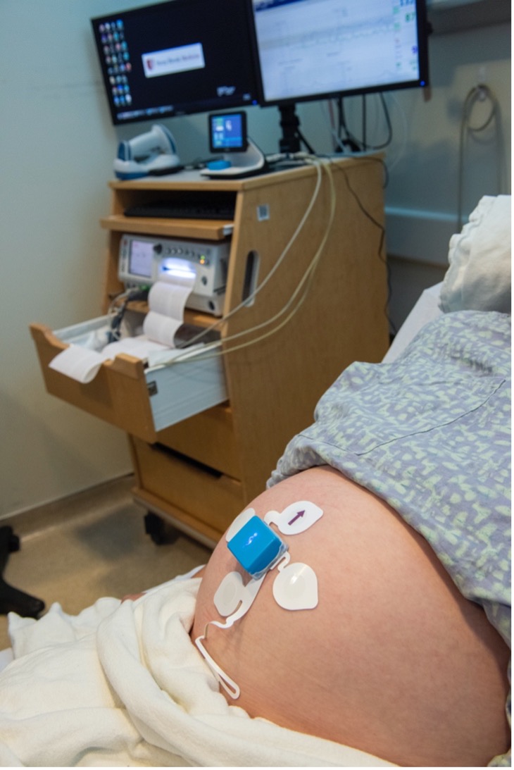 A device for monitoring fetal heart rate, maternal heart rate, and uterine activity. The signals acquired by these devices are processed and interpreted by machine learning methods.